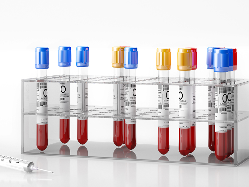 易感基因檢測(cè)